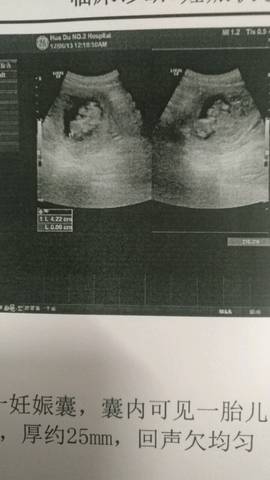 journal_insert_pic_770080164