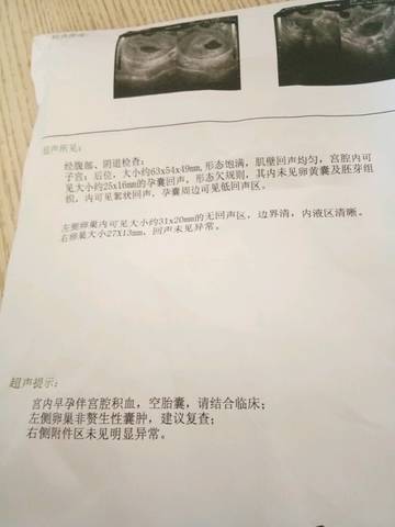journal_insert_pic_770397200