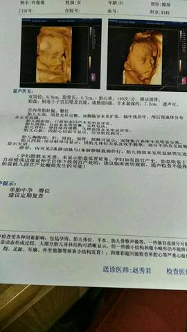 journal_insert_pic_772294948