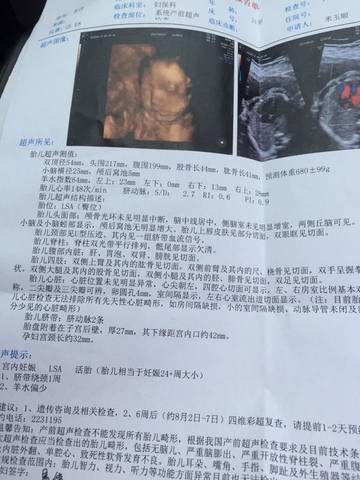 journal_insert_pic_772190740