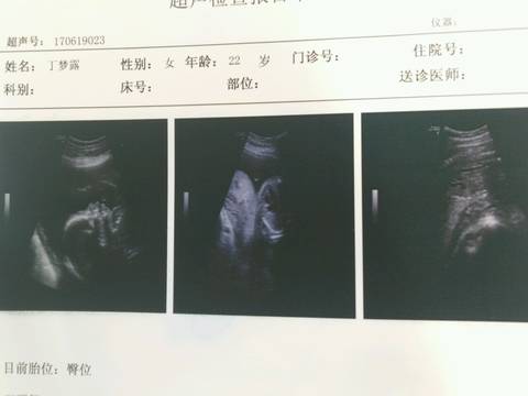 journal_insert_pic_772690432
