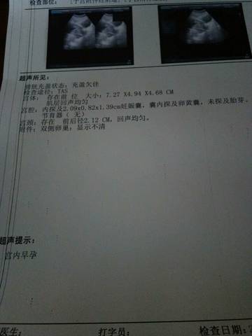 journal_insert_pic_772872782