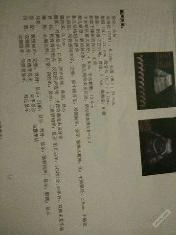 journal_insert_pic_773625471