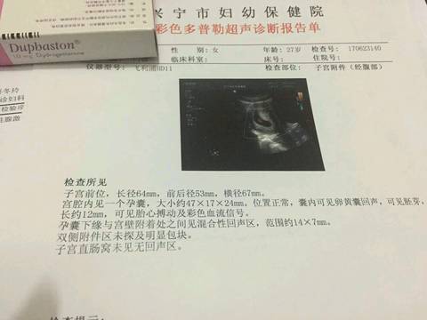 journal_insert_pic_775494454