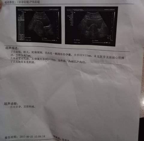 journal_insert_pic_776780063