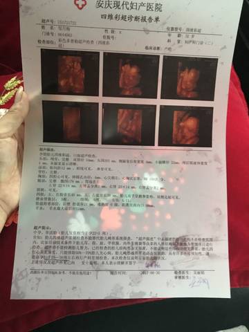 journal_insert_pic_780760582