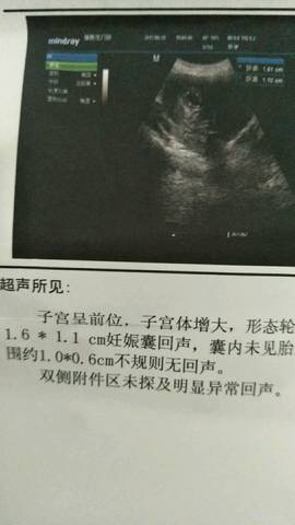 journal_insert_pic_781086438