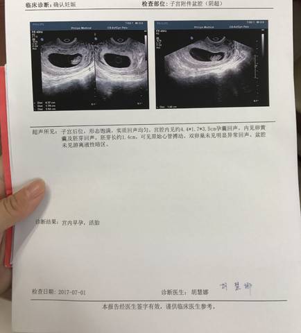 journal_insert_pic_781601477
