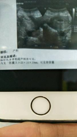 journal_insert_pic_783236200
