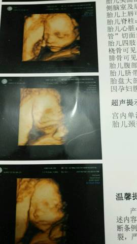 journal_insert_pic_784335355