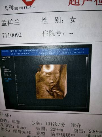 journal_insert_pic_785549333