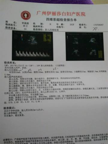 journal_insert_pic_787105298