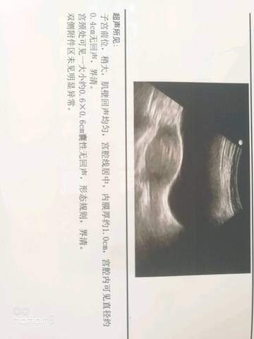 journal_insert_pic_787478931