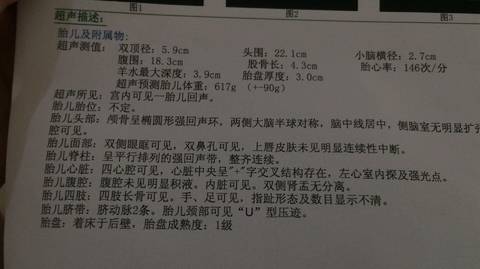 journal_insert_pic_788581549