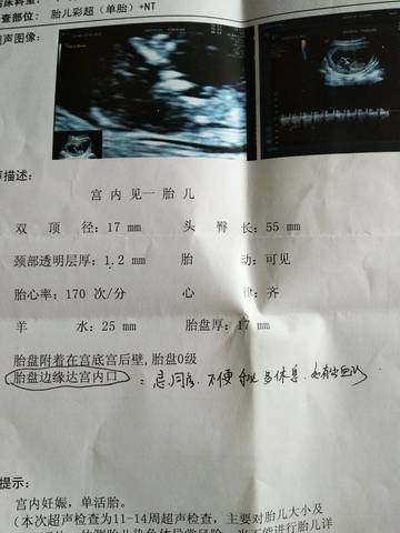 journal_insert_pic_788344457