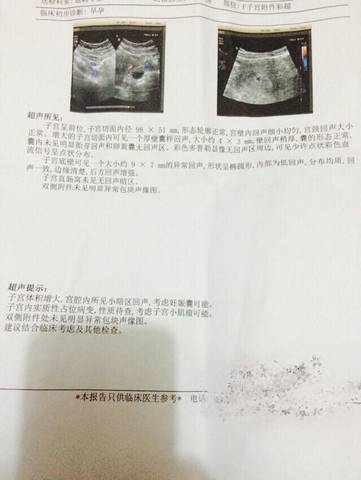 journal_insert_pic_790295239