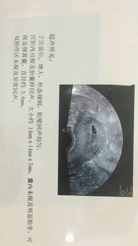 journal_insert_pic_790850046