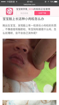 婴儿脸上有肉坠图片图片