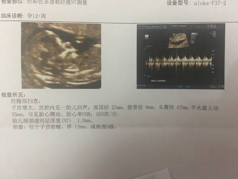 journal_insert_pic_791610843