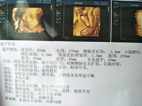 journal_insert_pic_794863384
