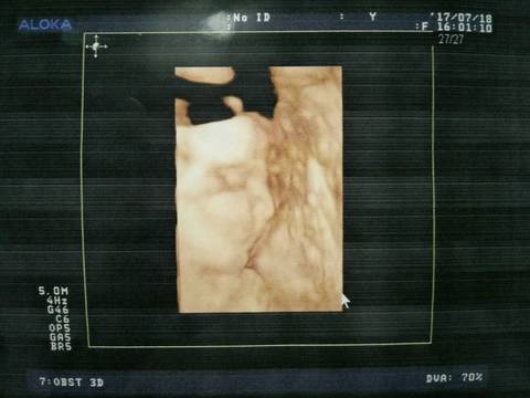 journal_insert_pic_795202923