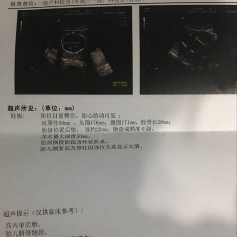 journal_insert_pic_796616605
