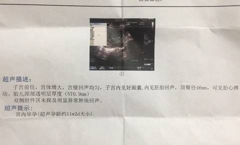 journal_insert_pic_796803951