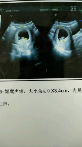 journal_insert_pic_800781023