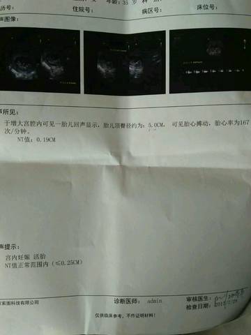 journal_insert_pic_801656173