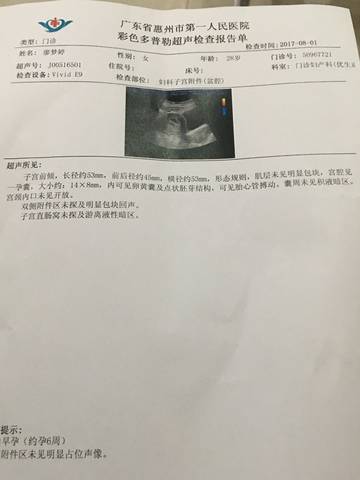 journal_insert_pic_804927667