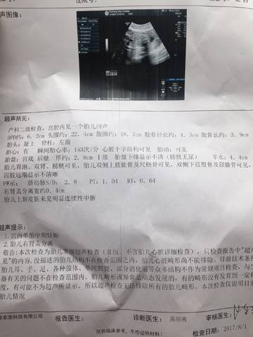 journal_insert_pic_805213048