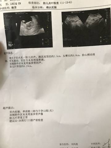 journal_insert_pic_804915894