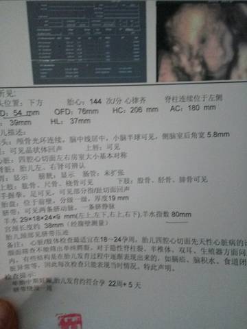 journal_insert_pic_806812257