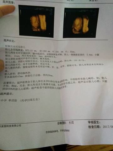 journal_insert_pic_808100303