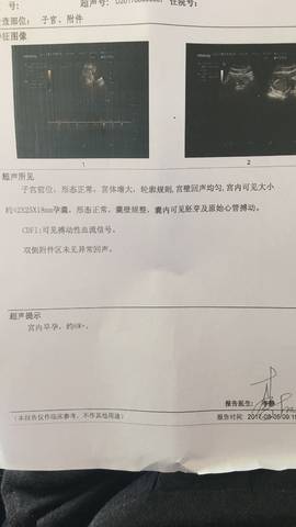 journal_insert_pic_808022101