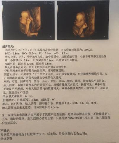 journal_insert_pic_808280962