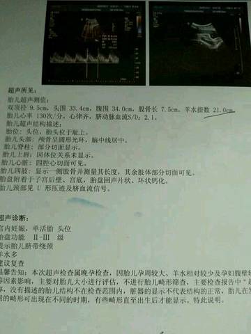 journal_insert_pic_810115663