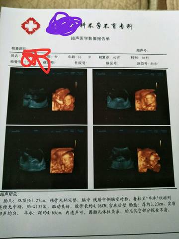 journal_insert_pic_813807977