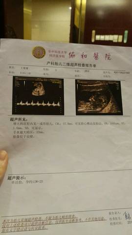 journal_insert_pic_813241550