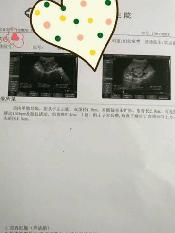 journal_insert_pic_813314586
