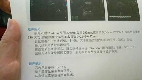 journal_insert_pic_814713203