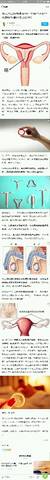 journal_insert_pic_815812634