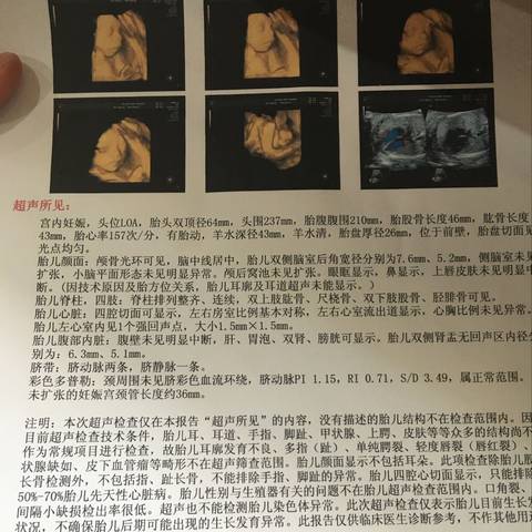 journal_insert_pic_815672465