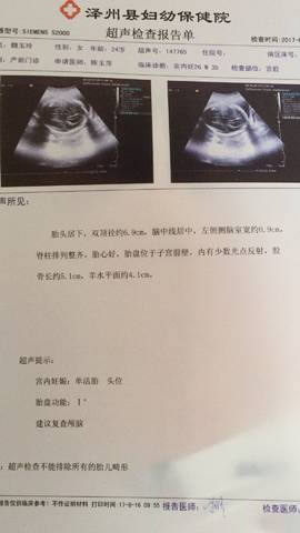 journal_insert_pic_816386314