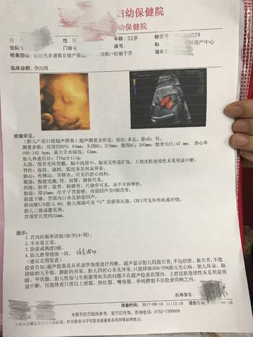 journal_insert_pic_816400799