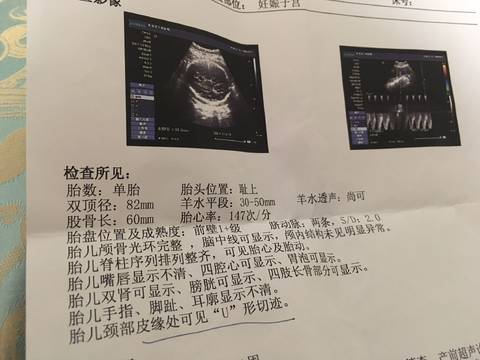 journal_insert_pic_817445899
