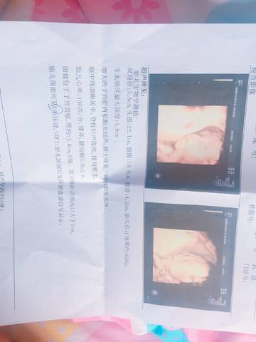 journal_insert_pic_820217749