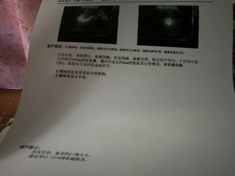 journal_insert_pic_821085042
