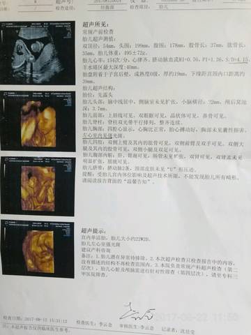 journal_insert_pic_820840368
