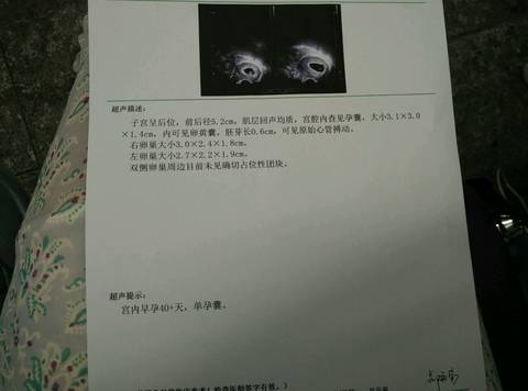 journal_insert_pic_820676253